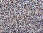 AKT1 Antibody in Immunohistochemistry (Paraffin) (IHC (P))