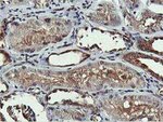 AKT1 Antibody in Immunohistochemistry (Paraffin) (IHC (P))