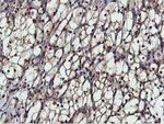 AKT1 Antibody in Immunohistochemistry (Paraffin) (IHC (P))