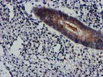 AKT1 Antibody in Immunohistochemistry (Paraffin) (IHC (P))