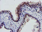 AKT1 Antibody in Immunohistochemistry (Paraffin) (IHC (P))