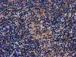 AKT1 Antibody in Immunohistochemistry (Paraffin) (IHC (P))