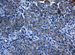 AKT1 Antibody in Immunohistochemistry (Paraffin) (IHC (P))