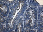AKT1 Antibody in Immunohistochemistry (Paraffin) (IHC (P))