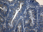 AKT1 Antibody in Immunohistochemistry (Paraffin) (IHC (P))