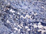 AKT1 Antibody in Immunohistochemistry (Paraffin) (IHC (P))