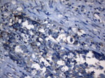 AKT1 Antibody in Immunohistochemistry (Paraffin) (IHC (P))