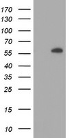 AKT1 Antibody in Western Blot (WB)