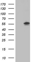 AKT1 Antibody in Western Blot (WB)