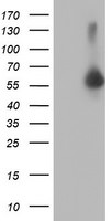 AKT1 Antibody in Western Blot (WB)