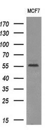 AKT1 Antibody in Western Blot (WB)