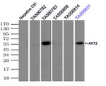AKT2 Antibody in Immunoprecipitation (IP)