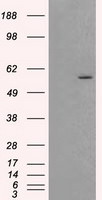 AKT2 Antibody in Western Blot (WB)