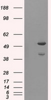 AKT2 Antibody in Western Blot (WB)