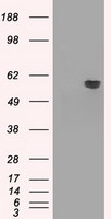 AKT2 Antibody in Western Blot (WB)