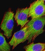AKT2 Antibody in Immunocytochemistry (ICC/IF)