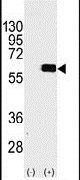 AKT2 Antibody in Western Blot (WB)