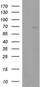 ALB Antibody in Western Blot (WB)