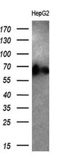 ALB Antibody in Western Blot (WB)