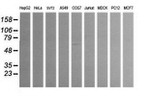ALDH1A3 Antibody in Western Blot (WB)
