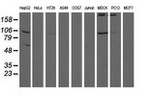 ALDH1L1 Antibody in Western Blot (WB)