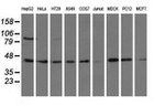 ALDH1L1 Antibody in Western Blot (WB)