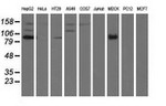 ALDH1L1 Antibody in Western Blot (WB)