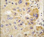 ALDH2 Antibody in Immunohistochemistry (IHC)