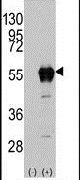 ALDH2 Antibody in Western Blot (WB)