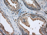ALDH3A1 Antibody in Immunohistochemistry (Paraffin) (IHC (P))