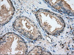 ALDH3A1 Antibody in Immunohistochemistry (Paraffin) (IHC (P))