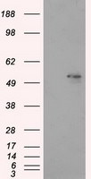 ALDH3A1 Antibody in Western Blot (WB)