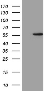 ALDH3B1 Antibody in Western Blot (WB)
