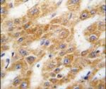 ALDH4A1 Antibody in Immunohistochemistry (IHC)