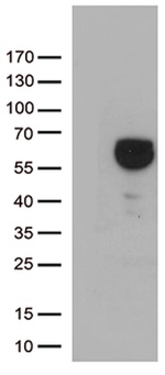 ALDH4A1 Antibody in Western Blot (WB)
