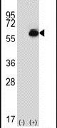 ALDH4A1 Antibody in Western Blot (WB)