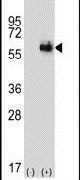 ALDH4A1 Antibody in Western Blot (WB)