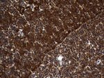 ALDH7A1 Antibody in Immunohistochemistry (Paraffin) (IHC (P))