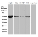 ALDH7A1 Antibody in Western Blot (WB)