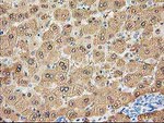 ALDOB Antibody in Immunohistochemistry (Paraffin) (IHC (P))