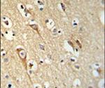 ALG10 Antibody in Immunohistochemistry (IHC)