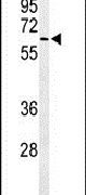 ALG10 Antibody in Western Blot (WB)