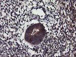 ALG2 Antibody in Immunohistochemistry (Paraffin) (IHC (P))