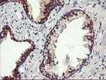 ALG2 Antibody in Immunohistochemistry (Paraffin) (IHC (P))