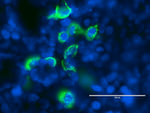 ALK Antibody in Immunocytochemistry (ICC/IF)