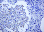 ALK Antibody in Immunohistochemistry (Paraffin) (IHC (P))