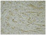 ALK Antibody in Immunohistochemistry (Paraffin) (IHC (P))