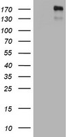 ALK Antibody in Western Blot (WB)