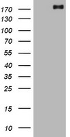 ALK Antibody in Western Blot (WB)