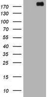 ALK Antibody in Western Blot (WB)